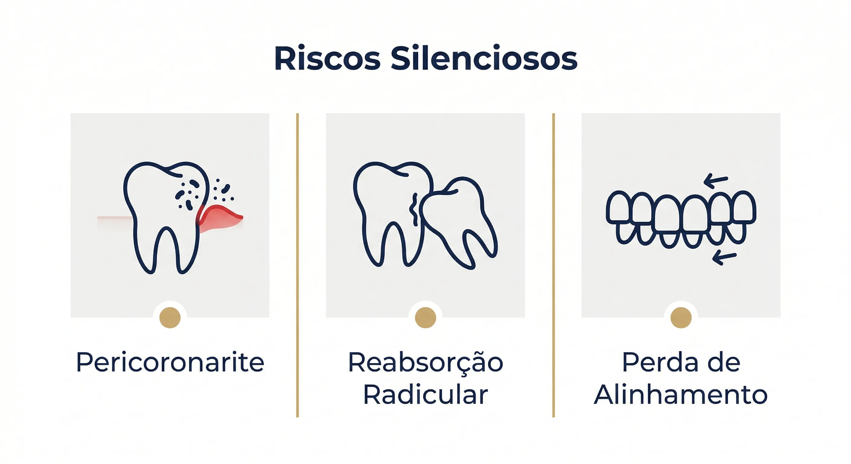 A posição do siso determina o tipo e a gravidade dos sintomas.